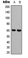 SYT1 / Synaptotagmin Antibody - Western blot analysis of Synaptotagmin expression in HEK293T (A); mouse brain (B) whole cell lysates.