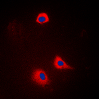 SYT1 / Synaptotagmin Antibody - Immunofluorescent analysis of Synaptotagmin staining in HeLa cells. Formalin-fixed cells were permeabilized with 0.1% Triton X-100 in TBS for 5-10 minutes and blocked with 3% BSA-PBS for 30 minutes at room temperature. Cells were probed with the primary antibody in 3% BSA-PBS and incubated overnight at 4 deg C in a humidified chamber. Cells were washed with PBST and incubated with a DyLight 594-conjugated secondary antibody (red) in PBS at room temperature in the dark. DAPI was used to stain the cell nuclei (blue).