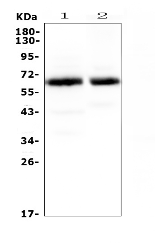 SYT1 / Synaptotagmin Antibody - Western blot analysis of Synaptotagmin 1 using anti-Synaptotagmin 1 antibody. Electrophoresis was performed on a 5-20% SDS-PAGE gel at 70V (Stacking gel) / 90V (Resolving gel) for 2-3 hours. The sample well of each lane was loaded with 50ug of sample under reducing conditions. Lane 1: rat brain tissue lysates,Lane 2: mouse brain tissue lysates. After Electrophoresis, proteins were transferred to a Nitrocellulose membrane at 150mA for 50-90 minutes. Blocked the membrane with 5% Non-fat Milk/ TBS for 1.5 hour at RT. The membrane was incubated with rabbit anti-Synaptotagmin 1 antigen affinity purified polyclonal antibody at 0.5 µg/mL overnight at 4°C, then washed with TBS-0.1% Tween 3 times with 5 minutes each and probed with a goat anti-rabbit IgG-HRP secondary antibody at a dilution of 1:10000 for 1.5 hour at RT. The signal is developed using an Enhanced Chemiluminescent detection (ECL) kit with Tanon 5200 system. A specific band was detected for Synaptotagmin 1 at approximately 65KD. The expected band size for Synaptotagmin 1 is at 47KD.