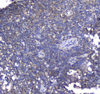 SYT1 / Synaptotagmin Antibody - IHC testing of FFPE mouse brain tissue with SYT1 antibody at 1ug/ml. Required HIER: steam section in pH6 citrate buffer for 20 min and allow to cool prior to staining.