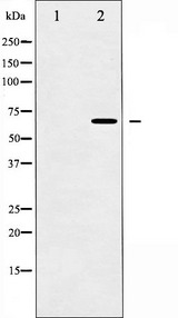 SYT1 / Synaptotagmin Antibody - Western blot analysis of Synaptotagmin expression in Forskolin treated 293 whole cells lysates. The lane on the left is treated with the antigen-specific peptide.