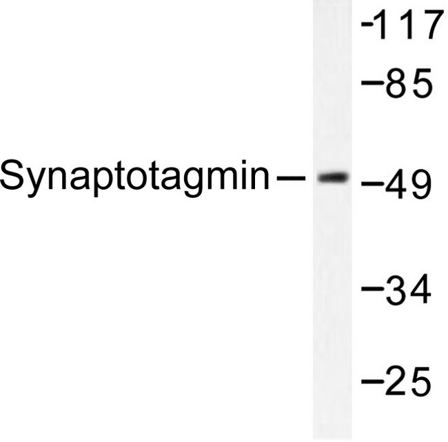 SYT1 / Synaptotagmin Antibody - Western blot of Synaptotagmin (M303) pAb in extracts from 293 cells Forskolin 40nM 30' or 293 cells Sorbitol 0.4M 30'.