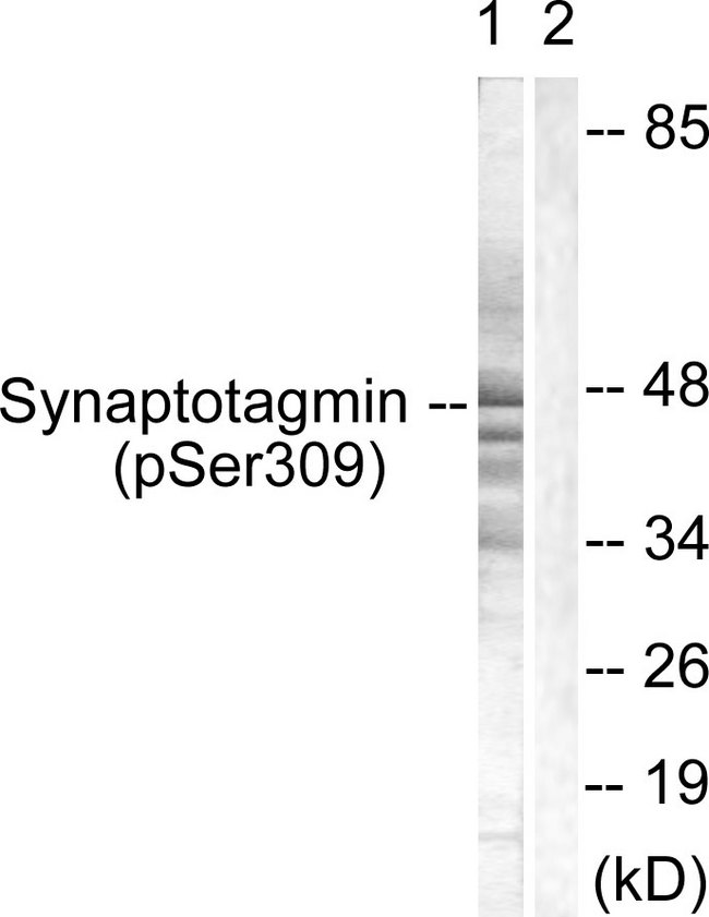 SYT1 / Synaptotagmin Antibody - Western blot analysis of lysates from 293 cells treated with Sobital 0.4M 30', using Synaptotagmin (Phospho-Ser309) Antibody. The lane on the right is blocked with the phospho peptide.