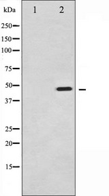 SYT1 / Synaptotagmin Antibody - Western blot analysis of Synaptotagmin phosphorylation expression in Sobital treated 293 whole cells lysates. The lane on the left is treated with the antigen-specific peptide.