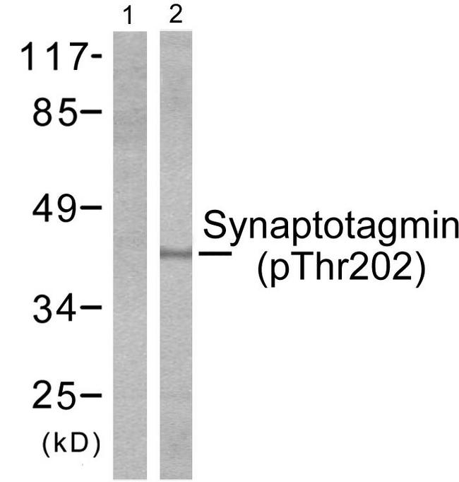 SYT1 / Synaptotagmin Antibody - Western blot analysis of lysates from 293 cells treated with Forskolin 40nM 30', using Synaptotagmin (Phospho-Thr202) Antibody. The lane on the left is blocked with the phospho peptide.