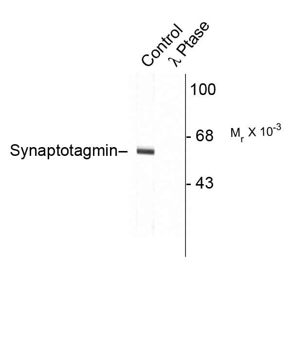 SYT1 / Synaptotagmin Antibody - Western blot of rat cortex lysate showing specific immunolabeling of the ~60k to ~62k synaptotagmin phosphorylated at Thr202 (Control). The phosphospecificity of this labeling is shown in the second lane (lambda-phosphatase: l-Ptase). The blot is identical to the control except that it was incubated in l-Ptase (1200 units for 30 min) before being exposed to the Anti-Thr202 synaptotagmin. The immunolabeling is completely eliminated by treatment with l-Ptase.