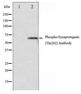 SYT1 / Synaptotagmin Antibody - Western blot of Synaptotagmin phosphorylation expression in Forskolin treated 293 whole cell lysates,The lane on the left is treated with the antigen-specific peptide.