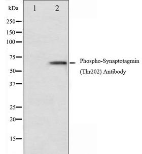 SYT1 / Synaptotagmin Antibody - Western blot analysis of Synaptotagmin phosphorylation expression in Forskolin treated 293 whole cells lysates. The lane on the left is treated with the antigen-specific peptide.