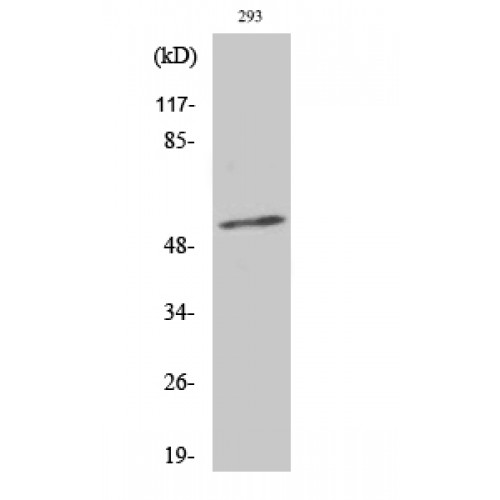 SYT1 + SYT2 Antibody - Western blot of Phospho-Synaptotagmin 1/2 (T202/199) antibody