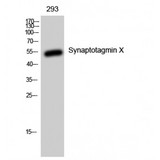 SYT10 / Synaptotagmin X Antibody - Western blot of Synaptotagmin X antibody