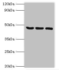 SYT11 Antibody - Western blot All lanes: SYT11 antibody at 14µg/ml Lane 1: COLO205 whole cell lysate Lane 2: Mouse skeletal muscle tissue Lane 3: MCF-7 whole cell lysate Secondary Goat polyclonal to rabbit IgG at 1/10000 dilution Predicted band size: 48 kDa Observed band size: 48 kDa
