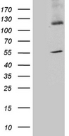 SYT11 Antibody - HEK293T cells were transfected with the pCMV6-ENTRY control. (Left lane) or pCMV6-ENTRY SYT11. (Right lane) cDNA for 48 hrs and lysed. Equivalent amounts of cell lysates. (5 ug per lane) were separated by SDS-PAGE and immunoblotted with anti-SYT11. (1:500)