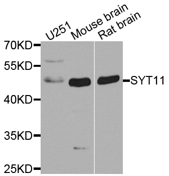 SYT11 Antibody - Western blot analysis of extract of various cells.