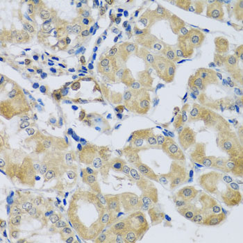 SYT11 Antibody - Immunohistochemistry of paraffin-embedded human stomach tissue.