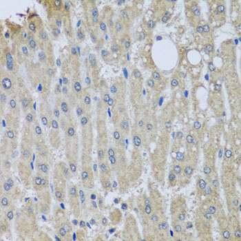 SYT11 Antibody - Immunohistochemistry of paraffin-embedded human liver injury tissue.