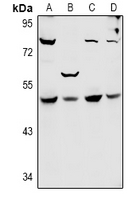 SYT11 Antibody - Western blot analysis of SYT11 expression in Hela (A), A549 (B), CT26 (C), PC12 (D) whole cell lysates.