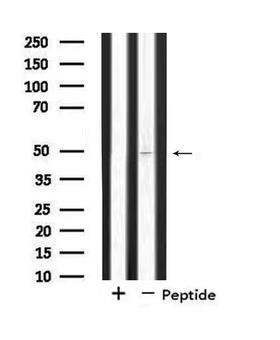 SYT11 Antibody - Western blot analysis of extracts of COLO205 cells using SYT11 antibody.