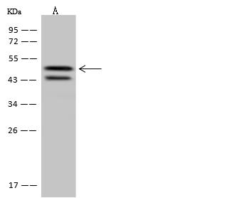 SYT11 Antibody - Anti-SYT11 rabbit polyclonal antibody at 1:500 dilution. Lane A: U-251 MG Whole Cell Lysate. Lysates/proteins at 30 ug per lane. Secondary: Goat Anti-Rabbit IgG (H+L)/HRP at 1/10000 dilution. Developed using the ECL technique. Performed under reducing conditions. Predicted band size: 48 kDa. Observed band size: 48 kDa. (We are unsure as to the identity of these extra bands.)