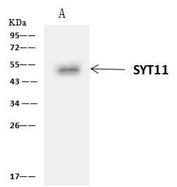 SYT11 Antibody - SYT11 was immunoprecipitated using: Lane A: 0.5 mg U-251 MG Whole Cell Lysate. 4 uL anti-SYT11 rabbit polyclonal antibody and 60 ug of Immunomagnetic beads Protein A/G. Primary antibody: Anti-SYT11 rabbit polyclonal antibody, at 1:100 dilution. Secondary antibody: Clean-Blot IP Detection Reagent (HRP) at 1:1000 dilution. Developed using the ECL technique. Performed under reducing conditions. Predicted band size: 48 kDa. Observed band size: 48 kDa.