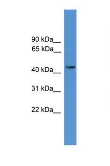 SYT12 / Synaptotagmin12 Antibody - SYT12 antibody Western blot of PANC1 Cell lysate. Antibody concentration 1 ug/ml.  This image was taken for the unconjugated form of this product. Other forms have not been tested.