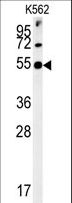 SYT13 Antibody - SYT13 Antibody western blot of K562 cell line lysates (35 ug/lane). The SYT13 antibody detected the SYT13 protein (arrow).