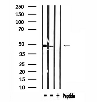 SYT13 Antibody - Western blot analysis of extracts of mouse kidney, mouse heart tissue using SYT13 antibody.