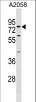 SYT16 Antibody - SYT16 Antibody western blot of A2058 cell line lysates (35 ug/lane). The SYT16 antibody detected the SYT16 protein (arrow).