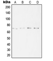 SYT16 Antibody - Western blot analysis of SYT16 expression in A431 (A); HeLa (B); A2058 (C); Jurkat (D) whole cell lysates.
