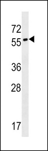SYT17 Antibody - SYT17 Antibody western blot of NCI-H460 cell line lysates (35 ug/lane). The SYT17 antibody detected the SYT17 protein (arrow).