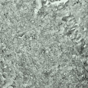 SYT17 Antibody - Rabbit antibody to SYT17. IHC on mouse brain (cryo section) using Rabbit antibody to Synaptotagmin 17at a concentration of 50 ug/ml incubated overnight at 4C.