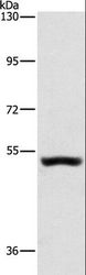 SYT17 Antibody - Western blot analysis of Mouse kidney tissue, using SYT17 Polyclonal Antibody at dilution of 1:650.