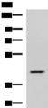 SYT2 Antibody - Western blot analysis of Hela cell lysate  using SYT2 Polyclonal Antibody at dilution of 1:800