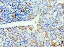 SYT4 Antibody - Immunohistochemistry of paraffin-embedded human pancreas tissue using antibody at 1:100 dilution.