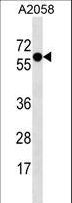 SYT4 Antibody - SYT4 Antibody western blot of A2058 cell line lysates (35 ug/lane). The SYT4 antibody detected the SYT4 protein (arrow).