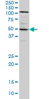 SYT4 Antibody - SYT4 monoclonal antibody (M04), clone 5F8 Western Blot analysis of SYT4 expression in A-431.