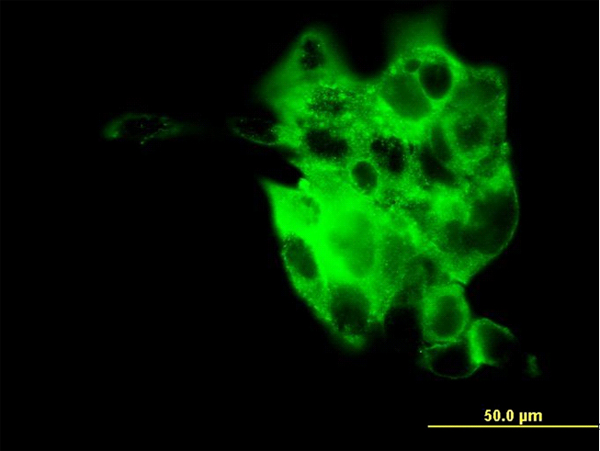 SYT4 Antibody - Immunofluorescence of monoclonal antibody to SYT4 on A-431 cell. [antibody concentration 10 ug/ml]