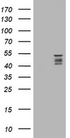 SYT4 Antibody - HEK293T cells were transfected with the pCMV6-ENTRY control (Left lane) or pCMV6-ENTRY SYT4 (Right lane) cDNA for 48 hrs and lysed. Equivalent amounts of cell lysates (5 ug per lane) were separated by SDS-PAGE and immunoblotted with anti-SYT4.