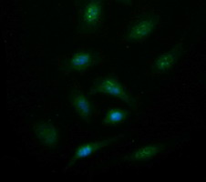SYT4 Antibody - Immunofluorescent staining of HeLa cells using anti-SYT4 mouse monoclonal antibody.