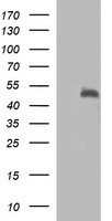 SYT4 Antibody - HEK293T cells were transfected with the pCMV6-ENTRY control (Left lane) or pCMV6-ENTRY SYT4 (Right lane) cDNA for 48 hrs and lysed. Equivalent amounts of cell lysates (5 ug per lane) were separated by SDS-PAGE and immunoblotted with anti-SYT4.