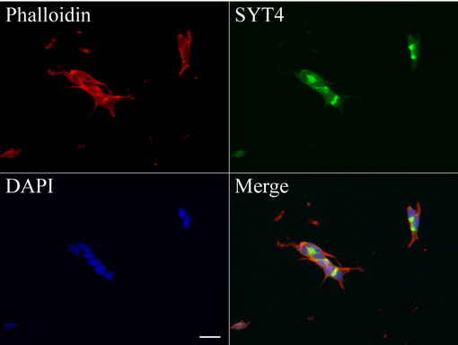 SYT4 Antibody - Immunofluorescent staining of SH-SY5Y cells using anti-SYT4 mouse monoclonal antibody  green, 1:100). Actin filaments were labeled with Alexa Fluor® 594 Phalloidin. (red), and nuclear with DAPI. (blue). Scale bar, 20µm.