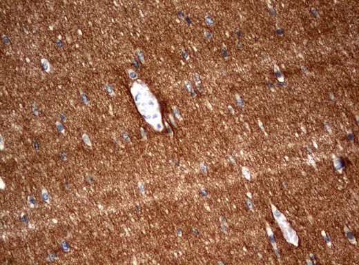 SYT4 Antibody - Immunohistochemical staining of paraffin-embedded Human embryonic brain cortex tissue using anti-SYT4 mouse monoclonal antibody.  heat-induced epitope retrieval by 10mM citric buffer, pH6.0, 120C for 3min)