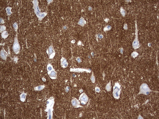 SYT4 Antibody - Immunohistochemical staining of paraffin-embedded Human adult brain tissue using anti-SYT4 mouse monoclonal antibody.  heat-induced epitope retrieval by 1 mM EDTA in 10mM Tris, pH8.0, 120C for 3min)
