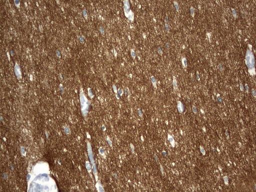 SYT4 Antibody - Immunohistochemical staining of paraffin-embedded Human embryonic brain cortex tissue using anti-SYT4 mouse monoclonal antibody.  heat-induced epitope retrieval by 1 mM EDTA in 10mM Tris, pH8.0, 120C for 3min)