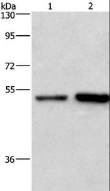 SYT4 Antibody - Western blot analysis of HeLa and Jurkat cell, using SYT4 Polyclonal Antibody at dilution of 1:700.