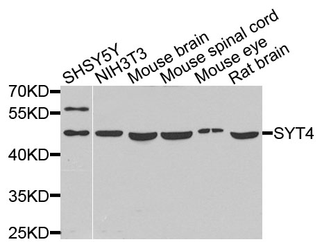 SYT4 Antibody - Western blot blot of extracts of various cells, using SYT4 antibody.