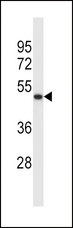 SYT5 Antibody - SYT5 Antibody western blot of K562 cell line lysates (35 ug/lane). The SYT5 antibody detected the SYT5 protein (arrow).