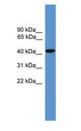 SYT5 Antibody - SYT5 antibody Western Blot of Fetal kidney lysate.  This image was taken for the unconjugated form of this product. Other forms have not been tested.