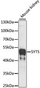 SYT5 Antibody - Western blot analysis of extracts of Mouse kidney, using SYT5 antibody at 1:1000 dilution. The secondary antibody used was an HRP Goat Anti-Rabbit IgG (H+L) at 1:10000 dilution. Lysates were loaded 25ug per lane and 3% nonfat dry milk in TBST was used for blocking. An ECL Kit was used for detection and the exposure time was 5s.