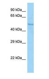 SYT7 / Synaptotagmin 7 Antibody - SYT7 antibody Western Blot of ACHN.  This image was taken for the unconjugated form of this product. Other forms have not been tested.