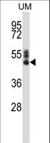 SYT7 / Synaptotagmin 7 Antibody - SYT7 Antibody western blot of human uterine tumor tissue lysates (35 ug/lane). The SYT7 antibody detected the SYT7 protein (arrow).
